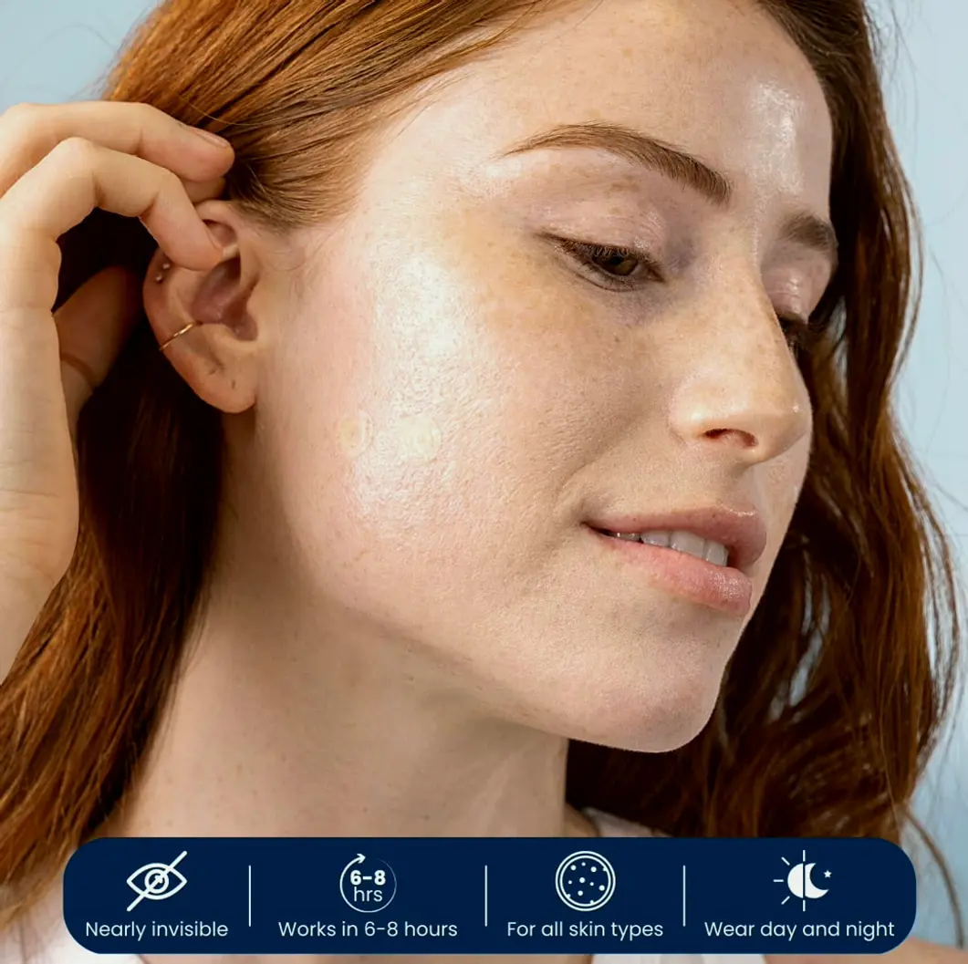 Invisible Pimple Patches - Zit Treatment Sticker