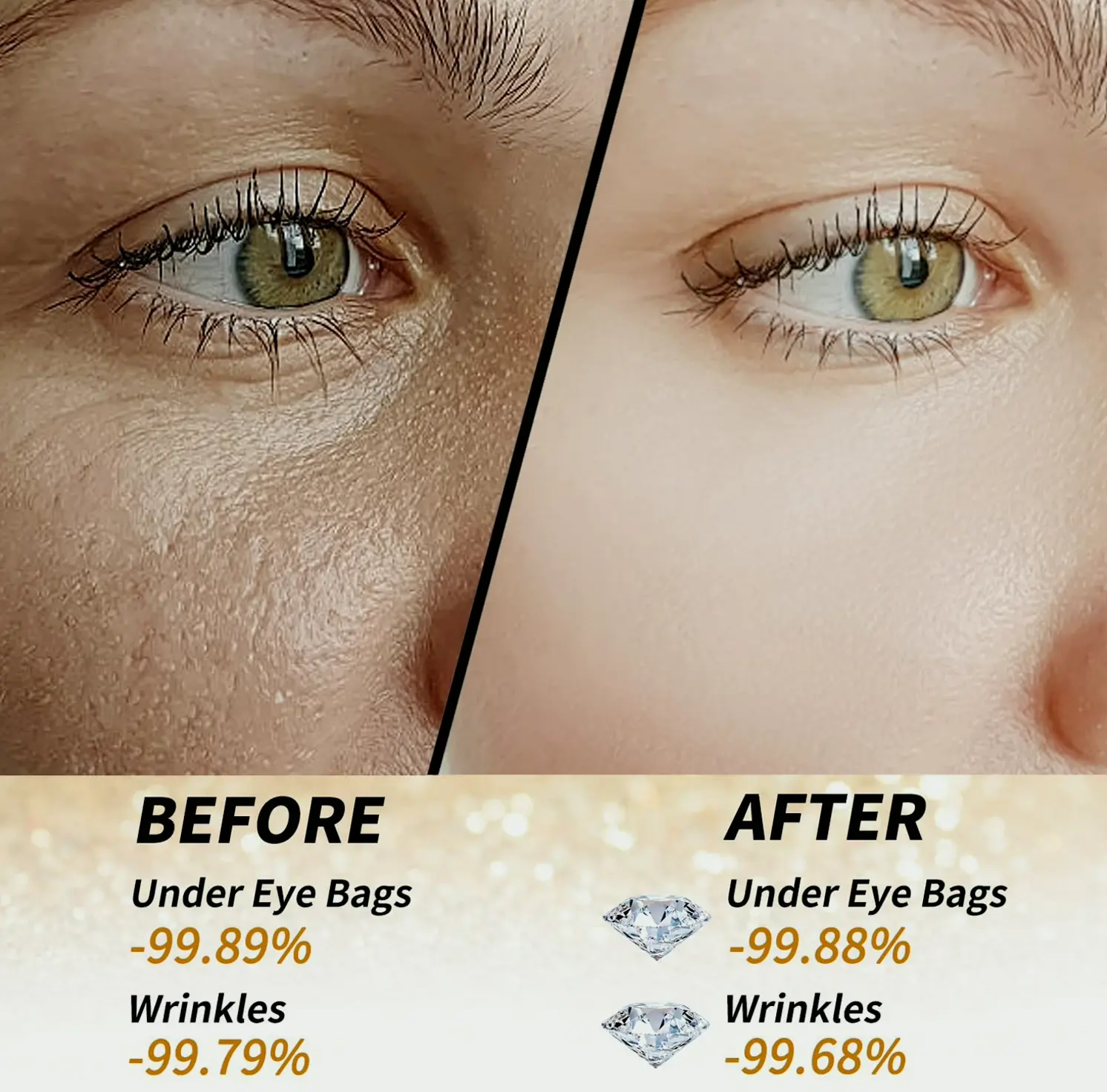 Radiant Shine Under Eye Patches - 60pcs Treatment for Puffy Eyes