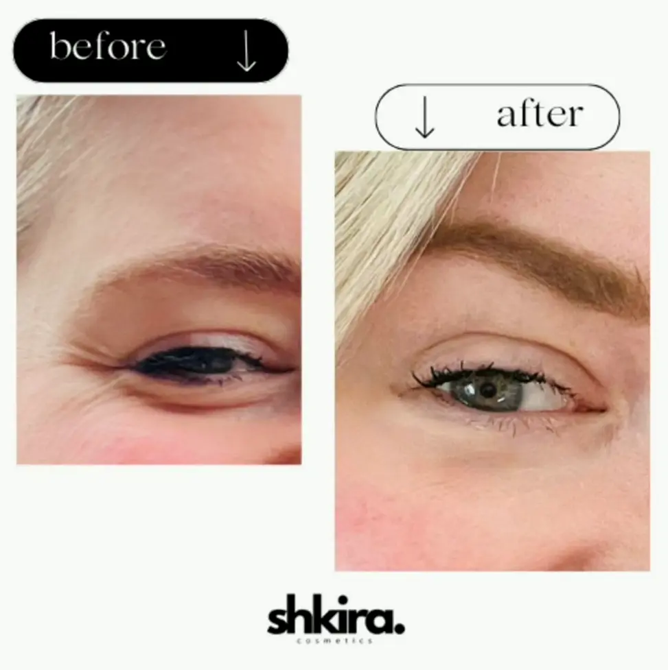 Coffee Under-Eye Serum | Decreases Swelling & Dark Circles