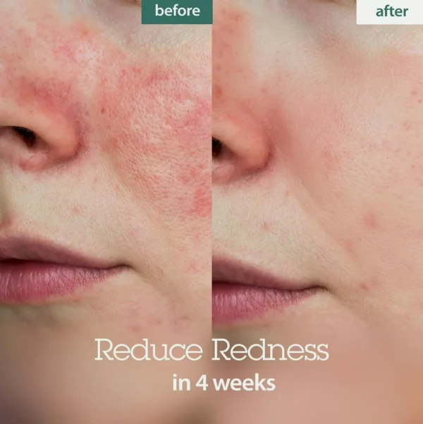 BLITHE's Pressed Moisturizer Crystal Iceplant Skin Serum - Top K-Beauty Product