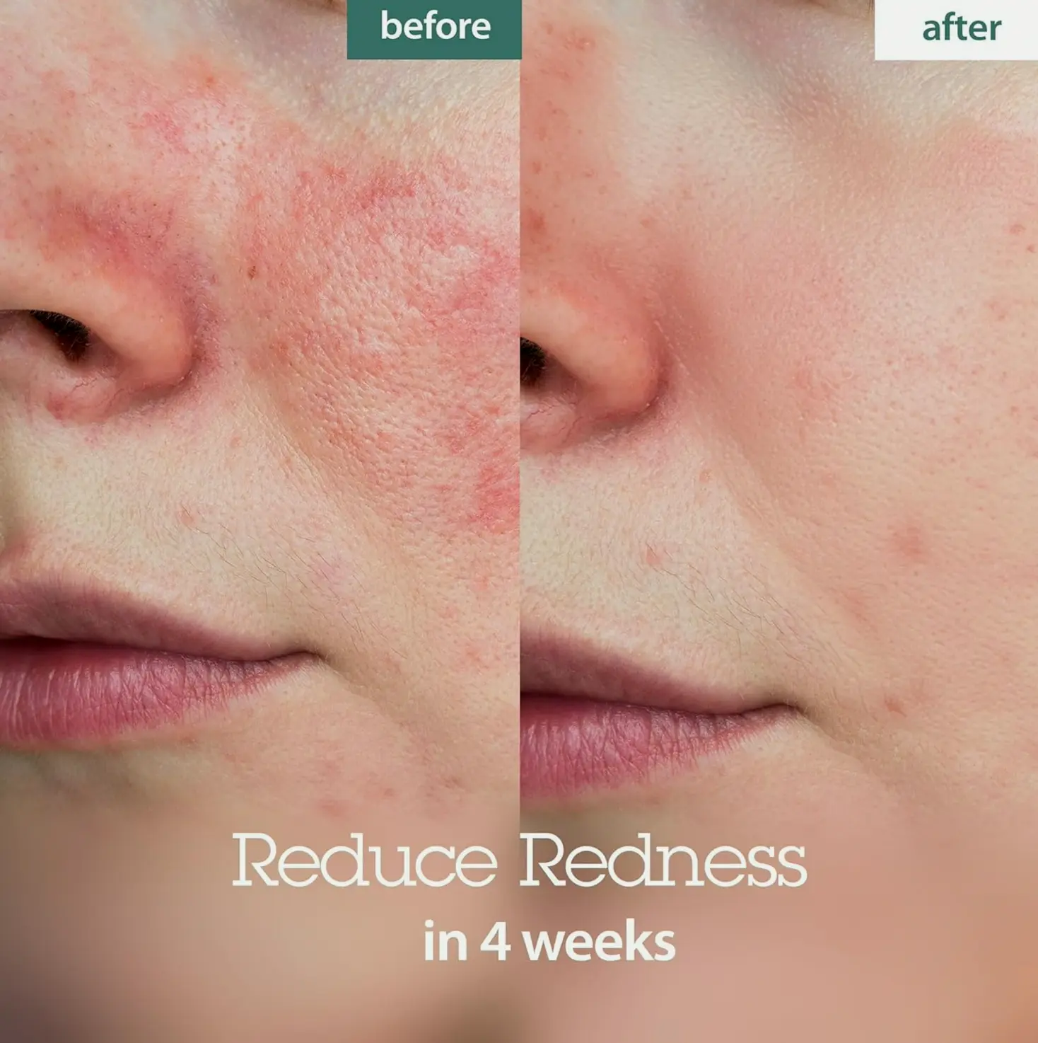 BLITHE's Pressed Moisturizer Crystal Iceplant Skin Serum - Top K-Beauty Product