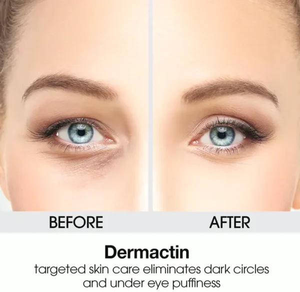 Upper Eyelid Cream - Dermactin-TS 1 Fl Ounce
