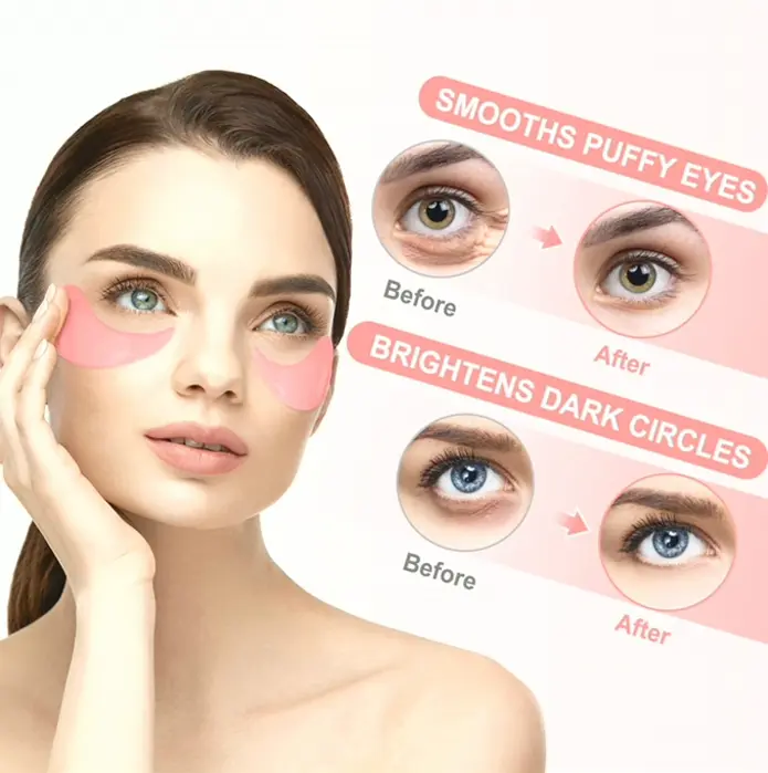 Rose Concealer Masks Set - Puffiness Treatment