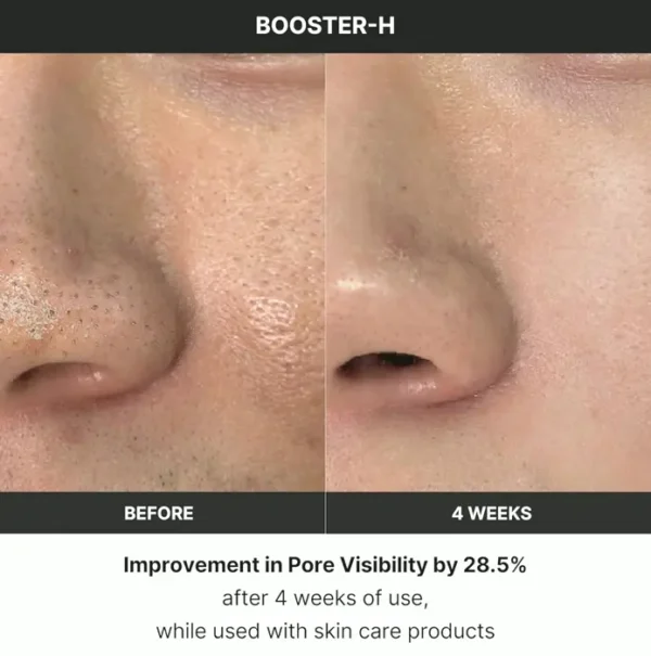 Korean Skincare Gadget - Medicube Age-R Booster H