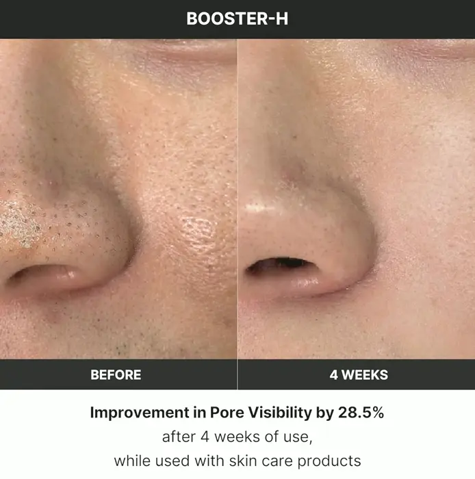 Korean Skincare Gadget - Medicube Age-R Booster H