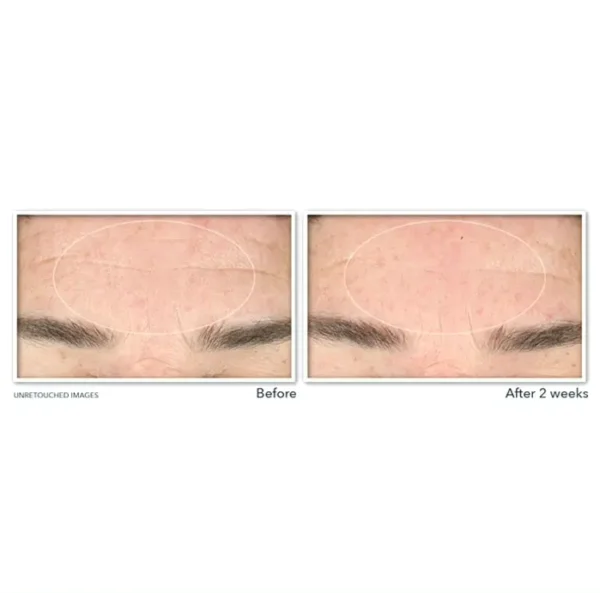 RoC's Retinol-Based Wrinkle Serum Face Wash, 6-Ounce Bottle