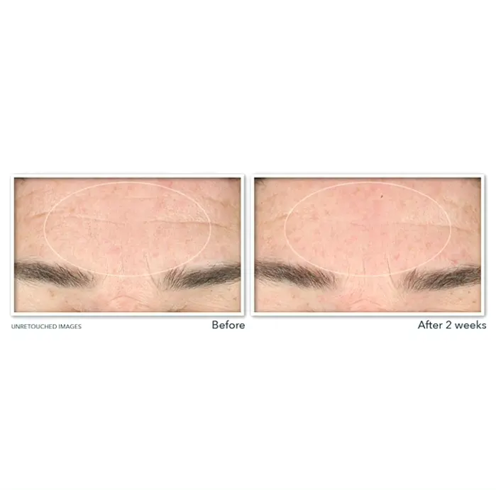 RoC's Retinol-Based Wrinkle Serum Face Wash, 6-Ounce Bottle