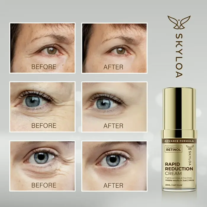 Retinol Eye Cream for Dark Circles and Wrinkles