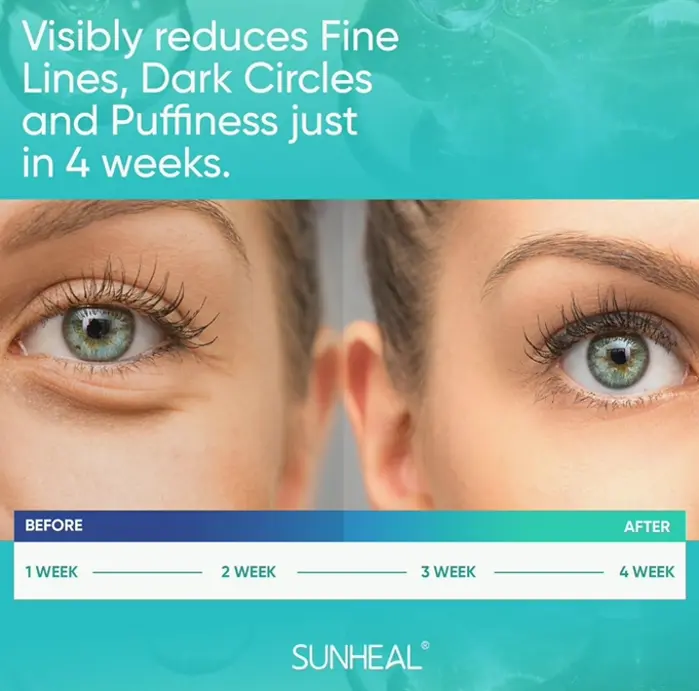 Vitamin A Eye Cream for Dark Circles & Swelling