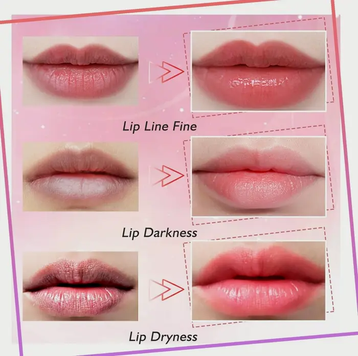 Collagen Lip Masks - Moisturize & Plump