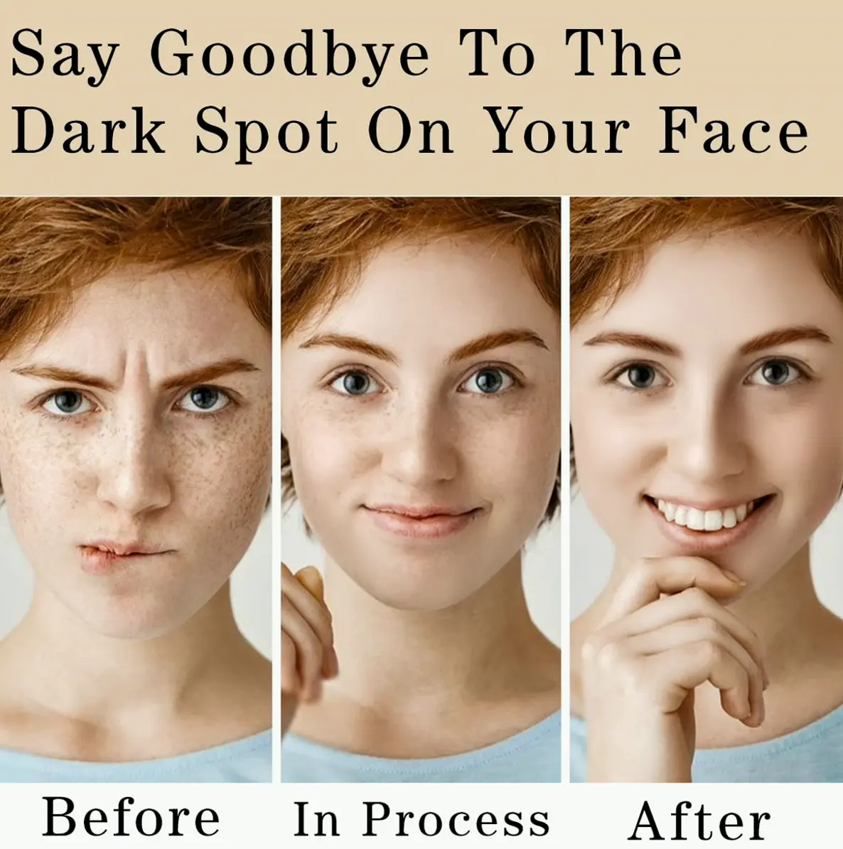 Black Spot Corrector Cream for Body
